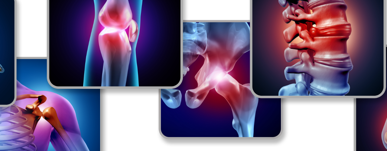 Arthritis Insync Wellness Brampton Ontario