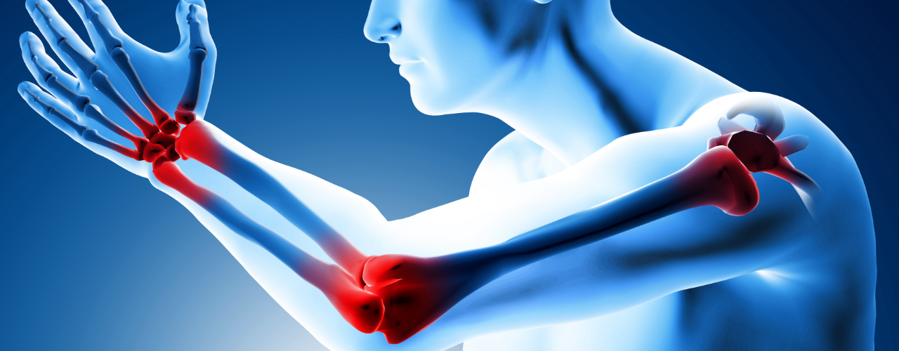 Elbow Wrist and Hand Pain Relief Insync Wellness Brampton Ontario