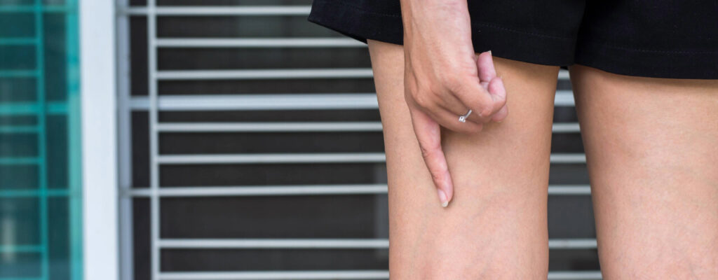 Understanding Post-Surgical Swelling: What's Normal